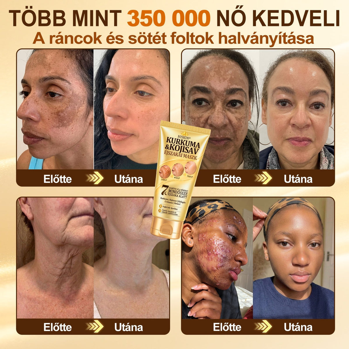 𝑯𝒊𝒗𝒂𝒕𝒂𝒍𝒐𝒔 𝑼̈𝒛𝒍𝒆𝒕 | 𝐔́𝐣! ✨ 𝐇𝐢𝐬𝐤𝐢𝐧® 𝐊𝐮𝐫𝐤𝐮𝐦𝐚 × 𝐊𝐨𝐣𝐢𝐧𝐬𝐚𝐯 𝐄́𝐣𝐬𝐳𝐚𝐤𝐚𝐢 𝐋𝐞𝐡𝐮́𝐳𝐡𝐚𝐭𝐨́ 𝐌𝐚𝐬𝐳𝐤 — 𝐇𝐚𝐥𝐯𝐚́𝐧𝐲𝐢́𝐭𝐬𝐝 𝐚 𝐦𝐚𝐤𝐚𝐜𝐬 𝐬𝐨̈𝐭𝐞́𝐭 𝐟𝐨𝐥𝐭𝐨𝐤𝐚𝐭 𝐞́𝐬 𝐬𝐢𝐦𝐢́𝐭𝐬𝐝 𝐤𝐢 𝐚 𝐥𝐚́𝐭𝐡𝐚𝐭𝐨́ 𝐫𝐚́𝐧𝐜𝐨𝐤𝐚𝐭 𝐚𝐥𝐯𝐚́𝐬 𝐤𝐨̈𝐳𝐛𝐞𝐧 🌙 ✅ 𝐄́𝐣𝐬𝐳𝐚𝐤𝐚́𝐧𝐤𝐞́𝐧𝐭 𝐞𝐠𝐲 𝐥𝐞́𝐩𝐞́𝐬 · 𝐋𝐚́𝐭𝐡𝐚𝐭𝐨́ 𝐯𝐚́𝐥𝐭𝐨𝐳𝐚́𝐬 𝟕 𝐞́𝐣𝐬𝐳𝐚𝐤𝐚 𝐚𝐥𝐚𝐭𝐭 💯