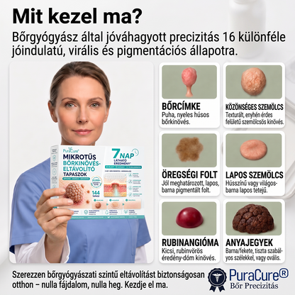 🌷𝐏𝐮𝐫𝐚𝐂𝐮𝐫𝐞® 𝐌𝐈𝐊𝐑𝐎𝐓Ű𝐒 𝐁Ő𝐑𝐊𝐈𝐍Ö𝐕É𝐒-𝐄𝐋𝐓Á𝐕𝐎𝐋Í𝐓Ó 𝐓𝐀𝐏𝐀𝐒𝐙𝐎𝐊 - ✅𝟕 𝐍𝐀𝐏𝐎𝐒 𝐂É𝐋𝐙𝐎𝐓𝐓 𝐄𝐋𝐓Á𝐕𝐎𝐋Í𝐓Á𝐒 𝐁Ő𝐑𝐍𝐘Ú𝐋𝐕Á𝐍𝐘𝐎𝐊, 𝐒𝐙𝐄𝐌Ö𝐋𝐂𝐒Ö𝐊 É𝐒 𝐊𝐈𝐄𝐌𝐄𝐋𝐊𝐄𝐃Ő 𝐁Ő𝐑𝐇𝐈𝐁Á𝐊 𝐄𝐋𝐋𝐄𝐍