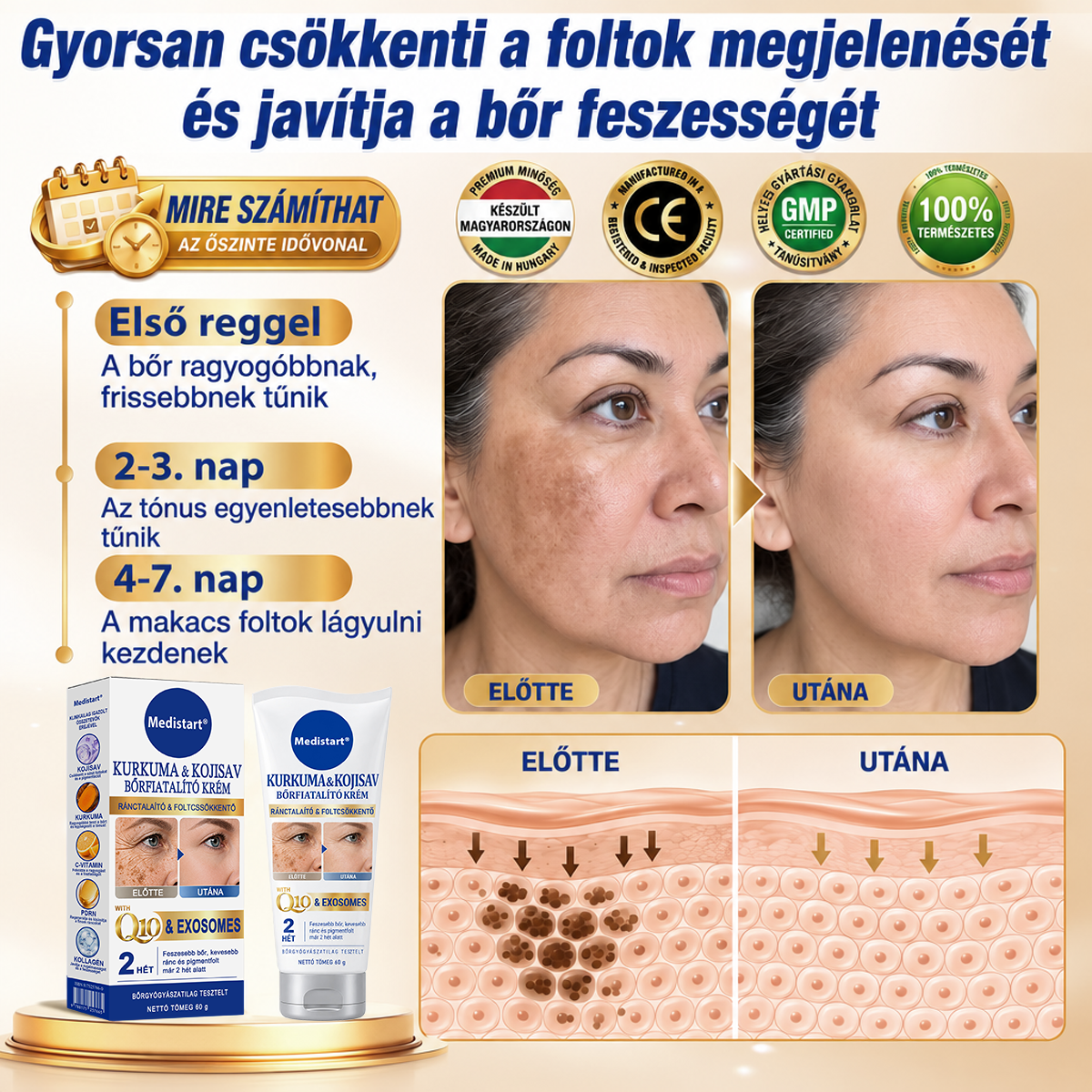 𝑯𝒊𝒗𝒂𝒕𝒂𝒍𝒐𝒔 𝑼̈𝒛𝒍𝒆𝒕 | 𝐔́𝐣! ✨ Medistart® 𝐊𝐮𝐫𝐤𝐮𝐦𝐚 × 𝐊𝐨𝐣𝐢𝐧𝐬𝐚𝐯 𝐄́𝐣𝐬𝐳𝐚𝐤𝐚𝐢 Bőrfiatalító 𝐊𝐫𝐞́𝐦— 𝐇𝐚𝐥𝐯𝐚́𝐧𝐲𝐢́𝐭𝐬𝐝 𝐚 𝐦𝐚𝐤𝐚𝐜𝐬 𝐬𝐨̈𝐭𝐞́𝐭 𝐟𝐨𝐥𝐭𝐨𝐤𝐚𝐭 𝐞́𝐬 𝐬𝐢𝐦𝐢́𝐭𝐬𝐝 𝐤𝐢 𝐚 𝐥𝐚́𝐭𝐡𝐚𝐭𝐨́ 𝐫𝐚́𝐧𝐜𝐨𝐤𝐚𝐭 𝐚𝐥𝐯𝐚́𝐬 𝐤𝐨̈𝐳𝐛𝐞𝐧 🌙 ✅ 𝐄́𝐣𝐬𝐳𝐚𝐤𝐚́𝐧𝐤𝐞́𝐧𝐭 𝐞𝐠𝐲 𝐥𝐞́𝐩𝐞́𝐬 · 𝐋𝐚́𝐭𝐡𝐚𝐭𝐨́ 𝐯𝐚́𝐥𝐭𝐨𝐳𝐚́𝐬 𝟕 𝐞́𝐣𝐬𝐳𝐚𝐤𝐚 𝐚𝐥𝐚𝐭𝐭 💯