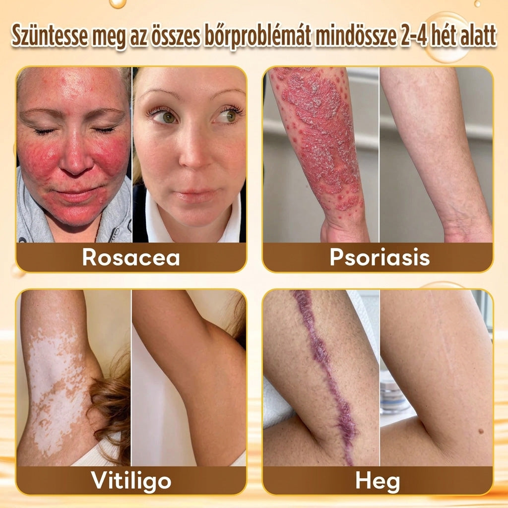 🐝PuraCure® TÖBBFÉLE BŐRPROBLÉMÁRA HATÓ MÉHMÉREG MIKROTŰS BŐRREGENERÁLÓ TAPASZOK