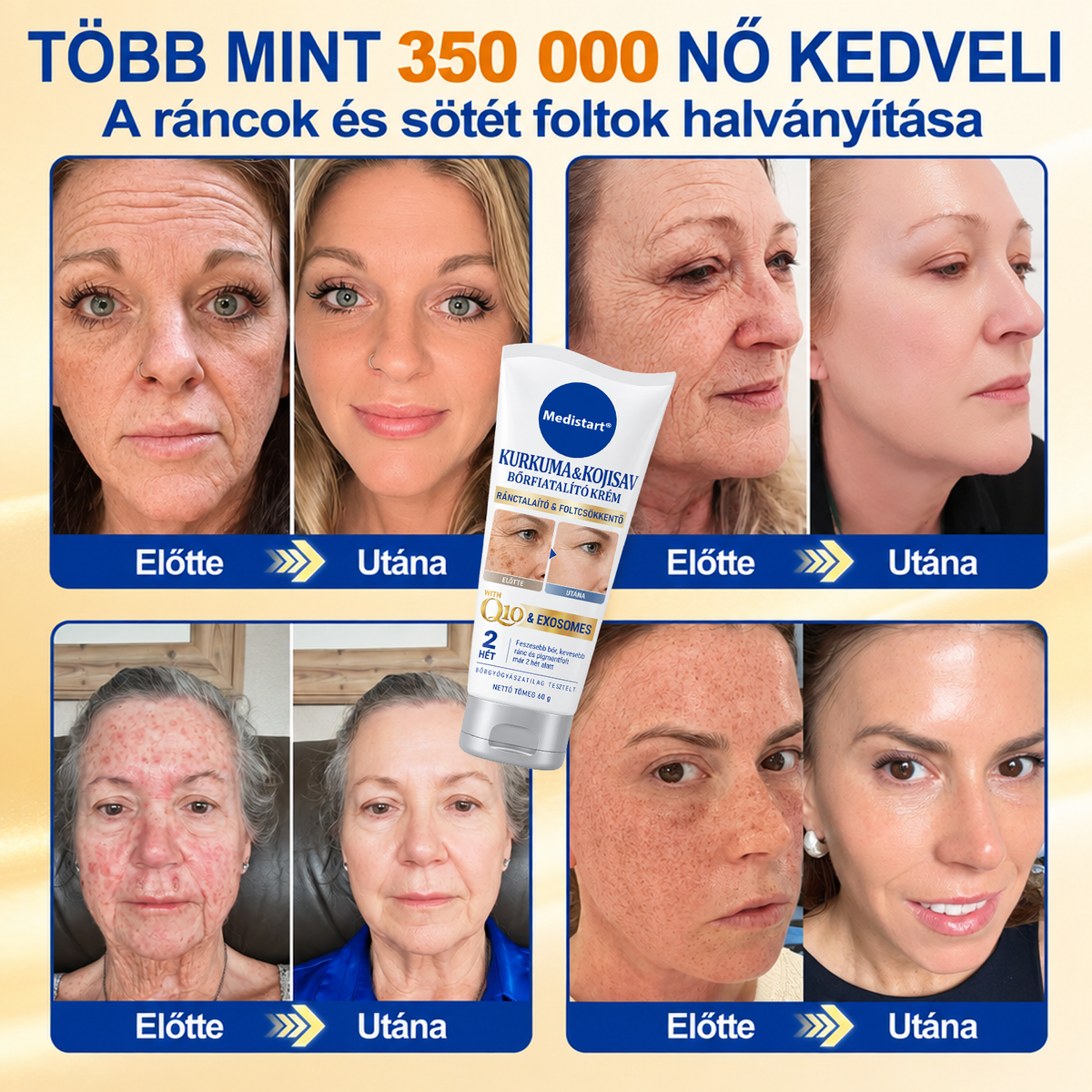 𝑯𝒊𝒗𝒂𝒕𝒂𝒍𝒐𝒔 𝑼̈𝒛𝒍𝒆𝒕 | 𝐔́𝐣! ✨ Medistart® 𝐊𝐮𝐫𝐤𝐮𝐦𝐚 × 𝐊𝐨𝐣𝐢𝐧𝐬𝐚𝐯 𝐄́𝐣𝐬𝐳𝐚𝐤𝐚𝐢 Bőrfiatalító 𝐊𝐫𝐞́𝐦— 𝐇𝐚𝐥𝐯𝐚́𝐧𝐲𝐢́𝐭𝐬𝐝 𝐚 𝐦𝐚𝐤𝐚𝐜𝐬 𝐬𝐨̈𝐭𝐞́𝐭 𝐟𝐨𝐥𝐭𝐨𝐤𝐚𝐭 𝐞́𝐬 𝐬𝐢𝐦𝐢́𝐭𝐬𝐝 𝐤𝐢 𝐚 𝐥𝐚́𝐭𝐡𝐚𝐭𝐨́ 𝐫𝐚́𝐧𝐜𝐨𝐤𝐚𝐭 𝐚𝐥𝐯𝐚́𝐬 𝐤𝐨̈𝐳𝐛𝐞𝐧 🌙 ✅ 𝐄́𝐣𝐬𝐳𝐚𝐤𝐚́𝐧𝐤𝐞́𝐧𝐭 𝐞𝐠𝐲 𝐥𝐞́𝐩𝐞́𝐬 · 𝐋𝐚́𝐭𝐡𝐚𝐭𝐨́ 𝐯𝐚́𝐥𝐭𝐨𝐳𝐚́𝐬 𝟕 𝐞́𝐣𝐬𝐳𝐚𝐤𝐚 𝐚𝐥𝐚𝐭𝐭 💯