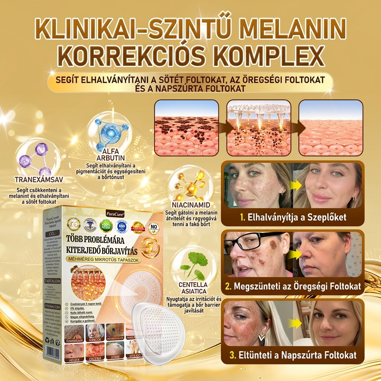 🐝PuraCure® TÖBBFÉLE BŐRPROBLÉMÁRA HATÓ MÉHMÉREG MIKROTŰS BŐRREGENERÁLÓ TAPASZOK