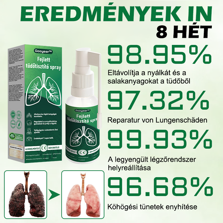 💚💚Gooyeer™ Fejlett Tüdőtisztító Spray - Tüdőspecialisták ajánlásával -CE tanúsítvánnyal rendelkezik