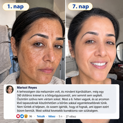 𝑯𝒊𝒗𝒂𝒕𝒂𝒍𝒐𝒔 𝑼̈𝒛𝒍𝒆𝒕 | 𝐔́𝐣! ✨ Medistart® 𝐊𝐮𝐫𝐤𝐮𝐦𝐚 × 𝐊𝐨𝐣𝐢𝐧𝐬𝐚𝐯 𝐄́𝐣𝐬𝐳𝐚𝐤𝐚𝐢 Bőrfiatalító 𝐊𝐫𝐞́𝐦— 𝐇𝐚𝐥𝐯𝐚́𝐧𝐲𝐢́𝐭𝐬𝐝 𝐚 𝐦𝐚𝐤𝐚𝐜𝐬 𝐬𝐨̈𝐭𝐞́𝐭 𝐟𝐨𝐥𝐭𝐨𝐤𝐚𝐭 𝐞́𝐬 𝐬𝐢𝐦𝐢́𝐭𝐬𝐝 𝐤𝐢 𝐚 𝐥𝐚́𝐭𝐡𝐚𝐭𝐨́ 𝐫𝐚́𝐧𝐜𝐨𝐤𝐚𝐭 𝐚𝐥𝐯𝐚́𝐬 𝐤𝐨̈𝐳𝐛𝐞𝐧 🌙 ✅ 𝐄́𝐣𝐬𝐳𝐚𝐤𝐚́𝐧𝐤𝐞́𝐧𝐭 𝐞𝐠𝐲 𝐥𝐞́𝐩𝐞́𝐬 · 𝐋𝐚́𝐭𝐡𝐚𝐭𝐨́ 𝐯𝐚́𝐥𝐭𝐨𝐳𝐚́𝐬 𝟕 𝐞́𝐣𝐬𝐳𝐚𝐤𝐚 𝐚𝐥𝐚𝐭𝐭 💯