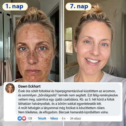 𝑯𝒊𝒗𝒂𝒕𝒂𝒍𝒐𝒔 𝑼̈𝒛𝒍𝒆𝒕 | 𝐔́𝐣! ✨ Medistart® 𝐊𝐮𝐫𝐤𝐮𝐦𝐚 × 𝐊𝐨𝐣𝐢𝐧𝐬𝐚𝐯 𝐄́𝐣𝐬𝐳𝐚𝐤𝐚𝐢 Bőrfiatalító 𝐊𝐫𝐞́𝐦— 𝐇𝐚𝐥𝐯𝐚́𝐧𝐲𝐢́𝐭𝐬𝐝 𝐚 𝐦𝐚𝐤𝐚𝐜𝐬 𝐬𝐨̈𝐭𝐞́𝐭 𝐟𝐨𝐥𝐭𝐨𝐤𝐚𝐭 𝐞́𝐬 𝐬𝐢𝐦𝐢́𝐭𝐬𝐝 𝐤𝐢 𝐚 𝐥𝐚́𝐭𝐡𝐚𝐭𝐨́ 𝐫𝐚́𝐧𝐜𝐨𝐤𝐚𝐭 𝐚𝐥𝐯𝐚́𝐬 𝐤𝐨̈𝐳𝐛𝐞𝐧 🌙 ✅ 𝐄́𝐣𝐬𝐳𝐚𝐤𝐚́𝐧𝐤𝐞́𝐧𝐭 𝐞𝐠𝐲 𝐥𝐞́𝐩𝐞́𝐬 · 𝐋𝐚́𝐭𝐡𝐚𝐭𝐨́ 𝐯𝐚́𝐥𝐭𝐨𝐳𝐚́𝐬 𝟕 𝐞́𝐣𝐬𝐳𝐚𝐤𝐚 𝐚𝐥𝐚𝐭𝐭 💯