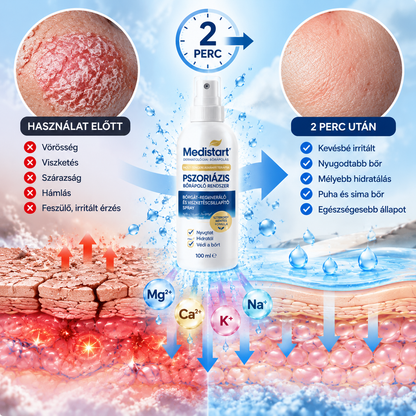 💧💧Medistart® Speciális Bőrápoló Krém Pikkelysömörös Bőrre - ✅Dermatológiailag tesztelt