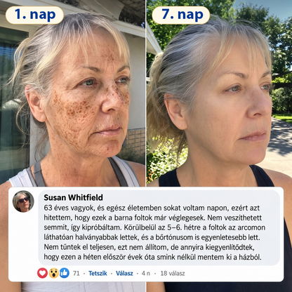 𝑯𝒊𝒗𝒂𝒕𝒂𝒍𝒐𝒔 𝑼̈𝒛𝒍𝒆𝒕 | 𝐔́𝐣! ✨ Medistart® 𝐊𝐮𝐫𝐤𝐮𝐦𝐚 × 𝐊𝐨𝐣𝐢𝐧𝐬𝐚𝐯 𝐄́𝐣𝐬𝐳𝐚𝐤𝐚𝐢 Bőrfiatalító 𝐊𝐫𝐞́𝐦— 𝐇𝐚𝐥𝐯𝐚́𝐧𝐲𝐢́𝐭𝐬𝐝 𝐚 𝐦𝐚𝐤𝐚𝐜𝐬 𝐬𝐨̈𝐭𝐞́𝐭 𝐟𝐨𝐥𝐭𝐨𝐤𝐚𝐭 𝐞́𝐬 𝐬𝐢𝐦𝐢́𝐭𝐬𝐝 𝐤𝐢 𝐚 𝐥𝐚́𝐭𝐡𝐚𝐭𝐨́ 𝐫𝐚́𝐧𝐜𝐨𝐤𝐚𝐭 𝐚𝐥𝐯𝐚́𝐬 𝐤𝐨̈𝐳𝐛𝐞𝐧 🌙 ✅ 𝐄́𝐣𝐬𝐳𝐚𝐤𝐚́𝐧𝐤𝐞́𝐧𝐭 𝐞𝐠𝐲 𝐥𝐞́𝐩𝐞́𝐬 · 𝐋𝐚́𝐭𝐡𝐚𝐭𝐨́ 𝐯𝐚́𝐥𝐭𝐨𝐳𝐚́𝐬 𝟕 𝐞́𝐣𝐬𝐳𝐚𝐤𝐚 𝐚𝐥𝐚𝐭𝐭 💯