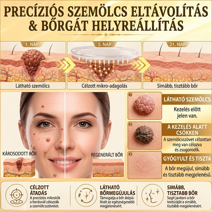 🐝PuraCure® TÖBBFÉLE BŐRPROBLÉMÁRA HATÓ MÉHMÉREG MIKROTŰS BŐRREGENERÁLÓ TAPASZOK