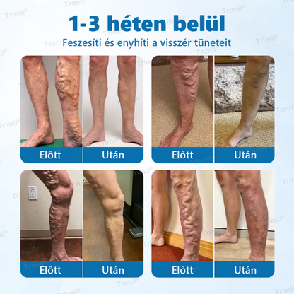 🎁💚🎁 Gratulálunk! Ön lett a mai nap szerencsés vásárlója! Most 50%-os exkluzív kedvezményt biztosítunk Önnek – támogassa lábai egészségét természetesen! A készlet korlátozott, rendelje meg még ma!