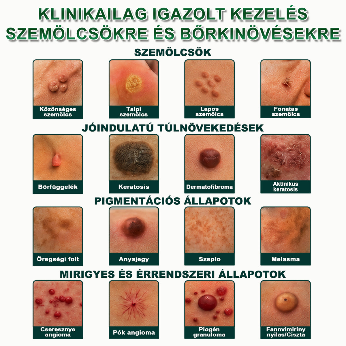 🌿𝐏𝐮𝐫𝐚𝐂𝐮𝐫𝐞® 𝐌𝐈𝐊𝐑𝐎𝐓Ű𝐒 𝐁Ő𝐑𝐊𝐈𝐍Ö𝐕É𝐒-𝐄𝐋𝐓Á𝐕𝐎𝐋Í𝐓Ó 𝐓𝐀𝐏𝐀𝐒𝐙𝐎𝐊 —𝟕 𝐍𝐀𝐏𝐎𝐒 𝐂É𝐋𝐙𝐎𝐓𝐓 𝐄𝐋𝐓Á𝐕𝐎𝐋Í𝐓Á𝐒 𝐁Ő𝐑𝐍𝐘Ú𝐋𝐕Á𝐍𝐘𝐎𝐊, 𝐒𝐙𝐄𝐌Ö𝐋𝐂𝐒Ö𝐊 É𝐒 𝐊𝐈𝐄𝐌𝐄𝐋𝐊𝐄𝐃Ő 𝐁Ő𝐑𝐇𝐈𝐁Á𝐊 𝐄𝐋𝐋𝐄𝐍