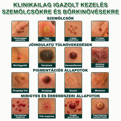 🌿𝐏𝐮𝐫𝐚𝐂𝐮𝐫𝐞® 𝐌𝐈𝐊𝐑𝐎𝐓Ű𝐒 𝐁Ő𝐑𝐊𝐈𝐍Ö𝐕É𝐒-𝐄𝐋𝐓Á𝐕𝐎𝐋Í𝐓Ó 𝐓𝐀𝐏𝐀𝐒𝐙𝐎𝐊 —𝟕 𝐍𝐀𝐏𝐎𝐒 𝐂É𝐋𝐙𝐎𝐓𝐓 𝐄𝐋𝐓Á𝐕𝐎𝐋Í𝐓Á𝐒 𝐁Ő𝐑𝐍𝐘Ú𝐋𝐕Á𝐍𝐘𝐎𝐊, 𝐒𝐙𝐄𝐌Ö𝐋𝐂𝐒Ö𝐊 É𝐒 𝐊𝐈𝐄𝐌𝐄𝐋𝐊𝐄𝐃Ő 𝐁Ő𝐑𝐇𝐈𝐁Á𝐊 𝐄𝐋𝐋𝐄𝐍