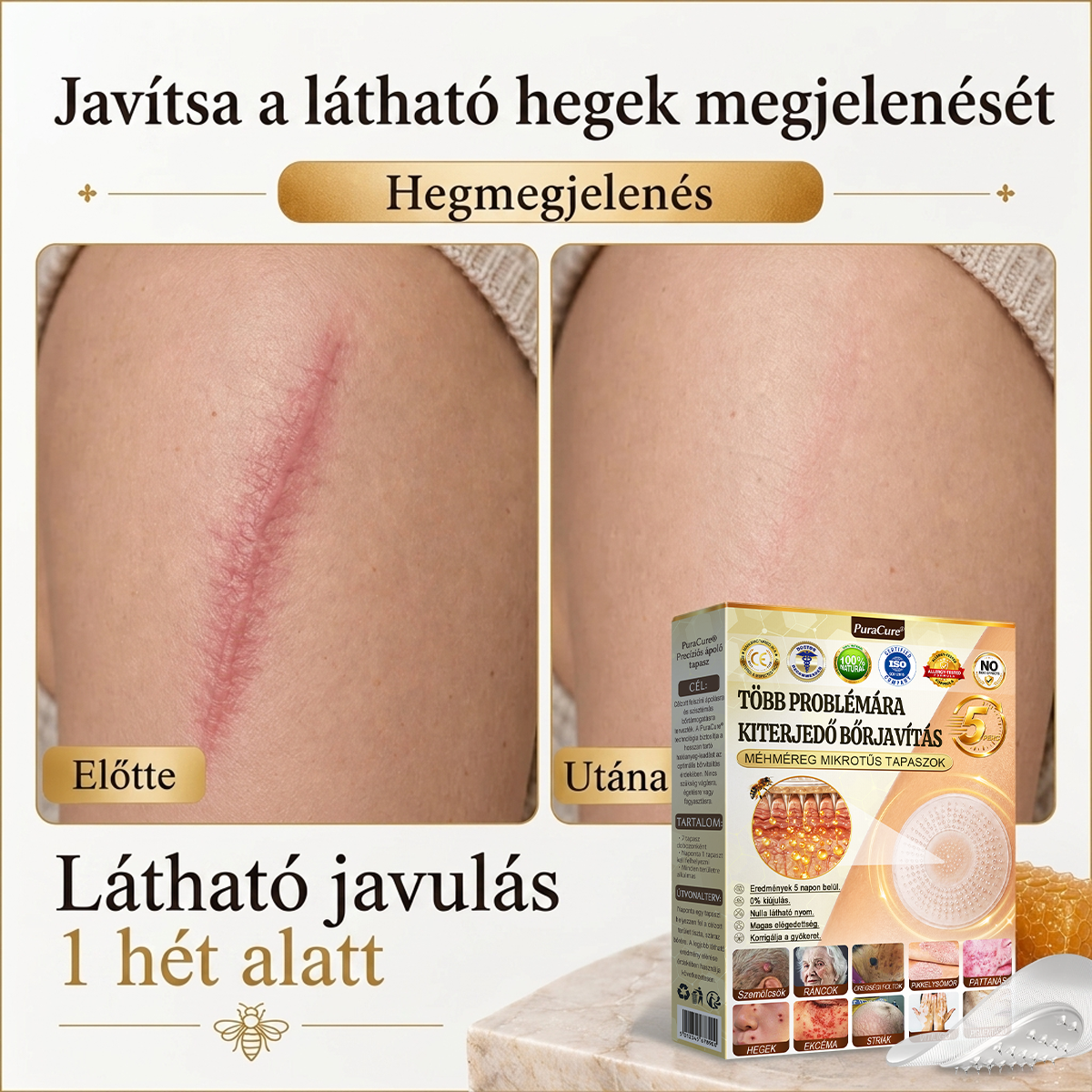 🐝PuraCure® TÖBBFÉLE BŐRPROBLÉMÁRA HATÓ MÉHMÉREG MIKROTŰS BŐRREGENERÁLÓ TAPASZOK