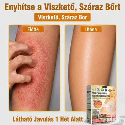 🐝PuraCure® TÖBBFÉLE BŐRPROBLÉMÁRA HATÓ MÉHMÉREG MIKROTŰS BŐRREGENERÁLÓ TAPASZOK