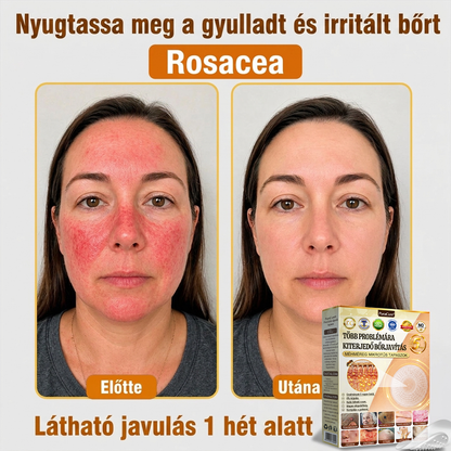 🐝PuraCure® TÖBBFÉLE BŐRPROBLÉMÁRA HATÓ MÉHMÉREG MIKROTŰS BŐRREGENERÁLÓ TAPASZOK