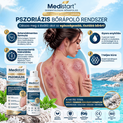 💧💧Medistart® Speciális Bőrápoló Krém Pikkelysömörös Bőrre - ✅Dermatológiailag tesztelt