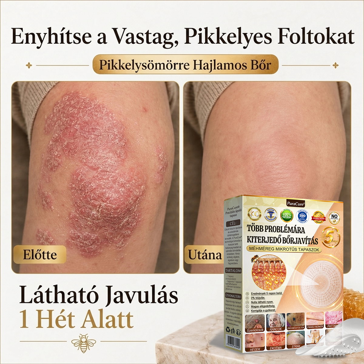 🐝PuraCure® TÖBBFÉLE BŐRPROBLÉMÁRA HATÓ MÉHMÉREG MIKROTŰS BŐRREGENERÁLÓ TAPASZOK