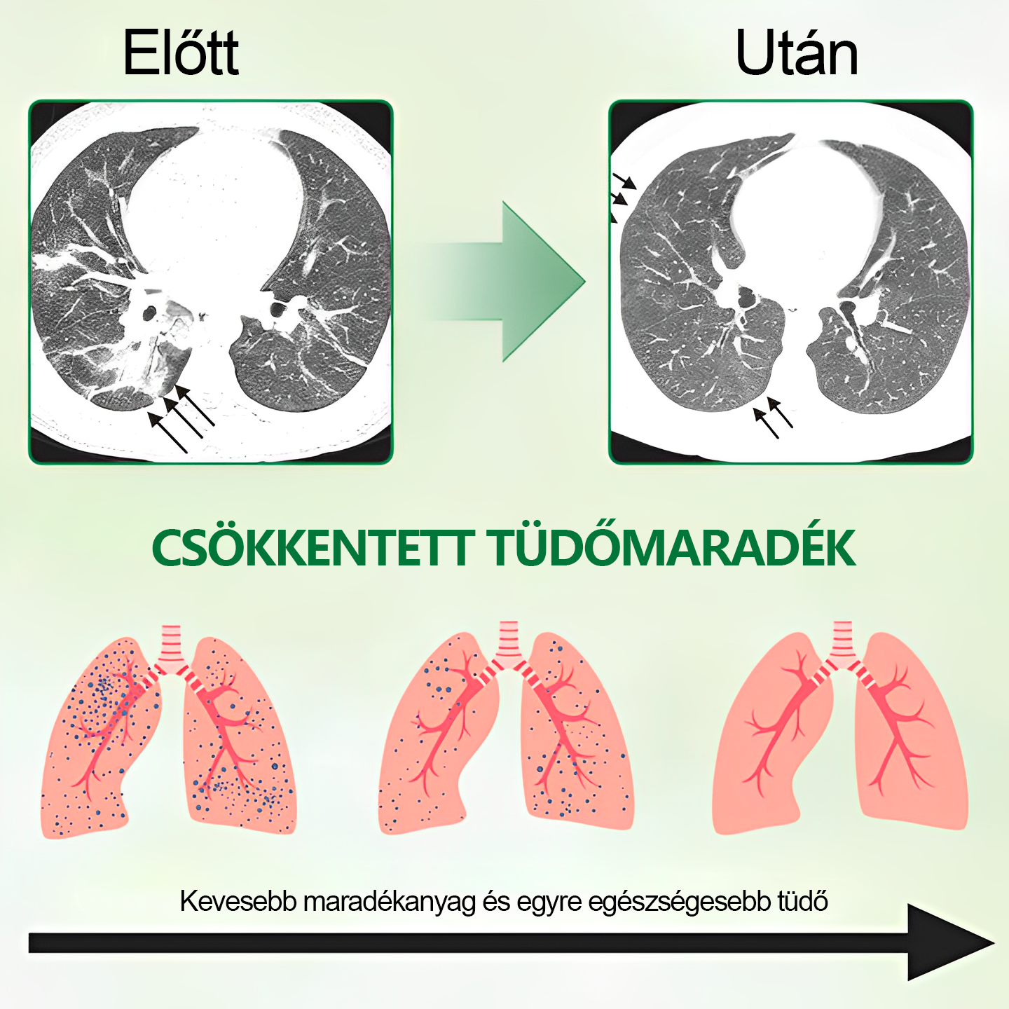 💚💚Gooyeer™ Fejlett Tüdőtisztító Spray - Tüdőspecialisták ajánlásával -CE tanúsítvánnyal rendelkezik