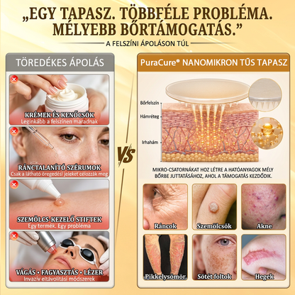 🐝PuraCure® TÖBBFÉLE BŐRPROBLÉMÁRA HATÓ MÉHMÉREG MIKROTŰS BŐRREGENERÁLÓ TAPASZOK
