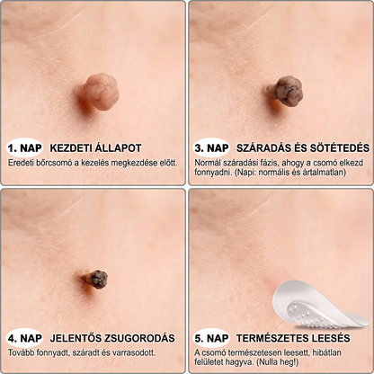 🌷𝐏𝐮𝐫𝐚𝐂𝐮𝐫𝐞® 𝐌𝐈𝐊𝐑𝐎𝐓Ű𝐒 𝐁Ő𝐑𝐊𝐈𝐍Ö𝐕É𝐒-𝐄𝐋𝐓Á𝐕𝐎𝐋Í𝐓Ó 𝐓𝐀𝐏𝐀𝐒𝐙𝐎𝐊 - ✅𝟕 𝐍𝐀𝐏𝐎𝐒 𝐂É𝐋𝐙𝐎𝐓𝐓 𝐄𝐋𝐓Á𝐕𝐎𝐋Í𝐓Á𝐒 𝐁Ő𝐑𝐍𝐘Ú𝐋𝐕Á𝐍𝐘𝐎𝐊, 𝐒𝐙𝐄𝐌Ö𝐋𝐂𝐒Ö𝐊 É𝐒 𝐊𝐈𝐄𝐌𝐄𝐋𝐊𝐄𝐃Ő 𝐁Ő𝐑𝐇𝐈𝐁Á𝐊 𝐄𝐋𝐋𝐄𝐍