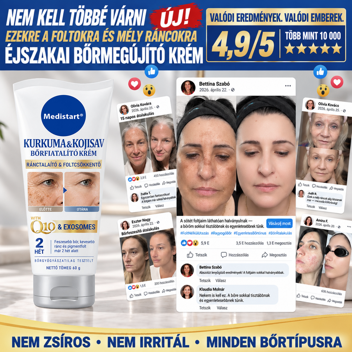 𝑯𝒊𝒗𝒂𝒕𝒂𝒍𝒐𝒔 𝑼̈𝒛𝒍𝒆𝒕 | 𝐔́𝐣! ✨ Medistart® 𝐊𝐮𝐫𝐤𝐮𝐦𝐚 × 𝐊𝐨𝐣𝐢𝐧𝐬𝐚𝐯 𝐄́𝐣𝐬𝐳𝐚𝐤𝐚𝐢 Bőrfiatalító 𝐊𝐫𝐞́𝐦— 𝐇𝐚𝐥𝐯𝐚́𝐧𝐲𝐢́𝐭𝐬𝐝 𝐚 𝐦𝐚𝐤𝐚𝐜𝐬 𝐬𝐨̈𝐭𝐞́𝐭 𝐟𝐨𝐥𝐭𝐨𝐤𝐚𝐭 𝐞́𝐬 𝐬𝐢𝐦𝐢́𝐭𝐬𝐝 𝐤𝐢 𝐚 𝐥𝐚́𝐭𝐡𝐚𝐭𝐨́ 𝐫𝐚́𝐧𝐜𝐨𝐤𝐚𝐭 𝐚𝐥𝐯𝐚́𝐬 𝐤𝐨̈𝐳𝐛𝐞𝐧 🌙 ✅ 𝐄́𝐣𝐬𝐳𝐚𝐤𝐚́𝐧𝐤𝐞́𝐧𝐭 𝐞𝐠𝐲 𝐥𝐞́𝐩𝐞́𝐬 · 𝐋𝐚́𝐭𝐡𝐚𝐭𝐨́ 𝐯𝐚́𝐥𝐭𝐨𝐳𝐚́𝐬 𝟕 𝐞́𝐣𝐬𝐳𝐚𝐤𝐚 𝐚𝐥𝐚𝐭𝐭 💯