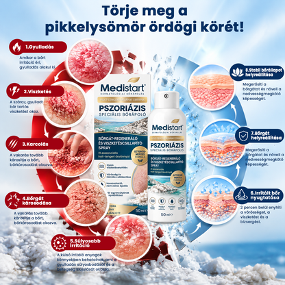💧💧Medistart® Speciális Bőrápoló Krém Pikkelysömörös Bőrre - ✅Dermatológiailag tesztelt