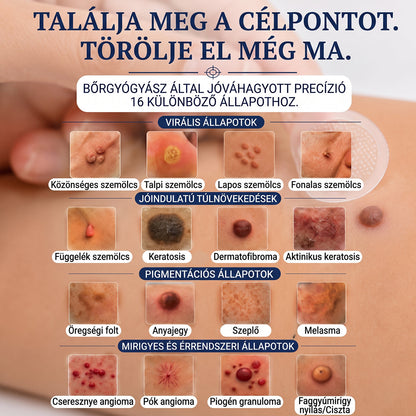 🌷𝐏𝐮𝐫𝐚𝐂𝐮𝐫𝐞® 𝐌𝐈𝐊𝐑𝐎𝐓Ű𝐒 𝐁Ő𝐑𝐊𝐈𝐍Ö𝐕É𝐒-𝐄𝐋𝐓Á𝐕𝐎𝐋Í𝐓Ó 𝐓𝐀𝐏𝐀𝐒𝐙𝐎𝐊 - ✅𝟕 𝐍𝐀𝐏𝐎𝐒 𝐂É𝐋𝐙𝐎𝐓𝐓 𝐄𝐋𝐓Á𝐕𝐎𝐋Í𝐓Á𝐒 𝐁Ő𝐑𝐍𝐘Ú𝐋𝐕Á𝐍𝐘𝐎𝐊, 𝐒𝐙𝐄𝐌Ö𝐋𝐂𝐒Ö𝐊 É𝐒 𝐊𝐈𝐄𝐌𝐄𝐋𝐊𝐄𝐃Ő 𝐁Ő𝐑𝐇𝐈𝐁Á𝐊 𝐄𝐋𝐋𝐄𝐍