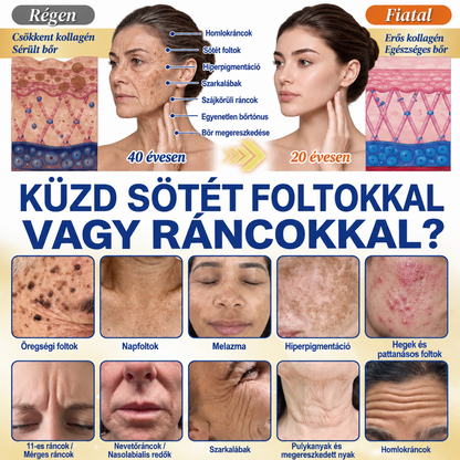𝑯𝒊𝒗𝒂𝒕𝒂𝒍𝒐𝒔 𝑼̈𝒛𝒍𝒆𝒕 | 𝐔́𝐣! ✨ Medistart® 𝐊𝐮𝐫𝐤𝐮𝐦𝐚 × 𝐊𝐨𝐣𝐢𝐧𝐬𝐚𝐯 𝐄́𝐣𝐬𝐳𝐚𝐤𝐚𝐢 Bőrfiatalító 𝐊𝐫𝐞́𝐦— 𝐇𝐚𝐥𝐯𝐚́𝐧𝐲𝐢́𝐭𝐬𝐝 𝐚 𝐦𝐚𝐤𝐚𝐜𝐬 𝐬𝐨̈𝐭𝐞́𝐭 𝐟𝐨𝐥𝐭𝐨𝐤𝐚𝐭 𝐞́𝐬 𝐬𝐢𝐦𝐢́𝐭𝐬𝐝 𝐤𝐢 𝐚 𝐥𝐚́𝐭𝐡𝐚𝐭𝐨́ 𝐫𝐚́𝐧𝐜𝐨𝐤𝐚𝐭 𝐚𝐥𝐯𝐚́𝐬 𝐤𝐨̈𝐳𝐛𝐞𝐧 🌙 ✅ 𝐄́𝐣𝐬𝐳𝐚𝐤𝐚́𝐧𝐤𝐞́𝐧𝐭 𝐞𝐠𝐲 𝐥𝐞́𝐩𝐞́𝐬 · 𝐋𝐚́𝐭𝐡𝐚𝐭𝐨́ 𝐯𝐚́𝐥𝐭𝐨𝐳𝐚́𝐬 𝟕 𝐞́𝐣𝐬𝐳𝐚𝐤𝐚 𝐚𝐥𝐚𝐭𝐭 💯