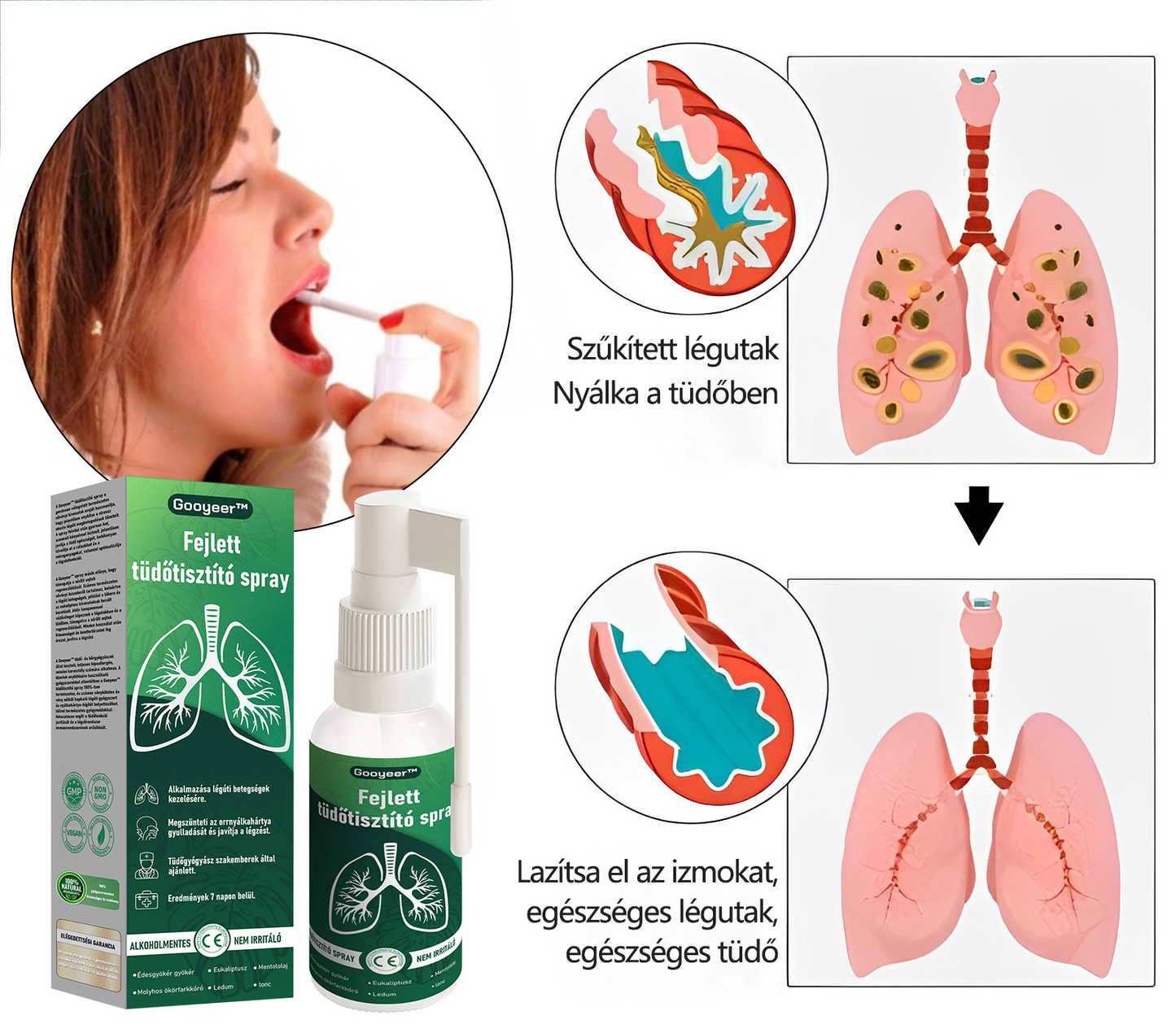 💚💚Gooyeer™ Fejlett Tüdőtisztító Spray - Tüdőspecialisták ajánlásával -CE tanúsítvánnyal rendelkezik