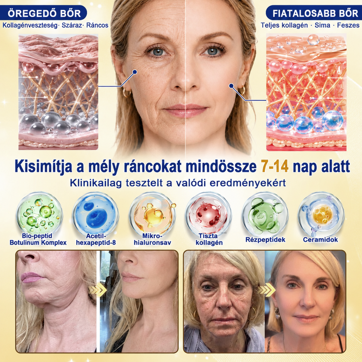 𝑯𝒊𝒗𝒂𝒕𝒂𝒍𝒐𝒔 𝑼̈𝒛𝒍𝒆𝒕 | 𝐔́𝐣! ✨ Medistart® 𝐊𝐮𝐫𝐤𝐮𝐦𝐚 × 𝐊𝐨𝐣𝐢𝐧𝐬𝐚𝐯 𝐄́𝐣𝐬𝐳𝐚𝐤𝐚𝐢 Bőrfiatalító 𝐊𝐫𝐞́𝐦— 𝐇𝐚𝐥𝐯𝐚́𝐧𝐲𝐢́𝐭𝐬𝐝 𝐚 𝐦𝐚𝐤𝐚𝐜𝐬 𝐬𝐨̈𝐭𝐞́𝐭 𝐟𝐨𝐥𝐭𝐨𝐤𝐚𝐭 𝐞́𝐬 𝐬𝐢𝐦𝐢́𝐭𝐬𝐝 𝐤𝐢 𝐚 𝐥𝐚́𝐭𝐡𝐚𝐭𝐨́ 𝐫𝐚́𝐧𝐜𝐨𝐤𝐚𝐭 𝐚𝐥𝐯𝐚́𝐬 𝐤𝐨̈𝐳𝐛𝐞𝐧 🌙 ✅ 𝐄́𝐣𝐬𝐳𝐚𝐤𝐚́𝐧𝐤𝐞́𝐧𝐭 𝐞𝐠𝐲 𝐥𝐞́𝐩𝐞́𝐬 · 𝐋𝐚́𝐭𝐡𝐚𝐭𝐨́ 𝐯𝐚́𝐥𝐭𝐨𝐳𝐚́𝐬 𝟕 𝐞́𝐣𝐬𝐳𝐚𝐤𝐚 𝐚𝐥𝐚𝐭𝐭 💯