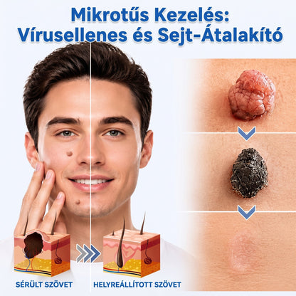 🎁🔥🎁 Gratulálunk! Ön kiválasztásra került mai exkluzív ajánlatunkhoz! Most 30% kedvezménnyel szerezheti be a PuraCure® MIKROTŰS TISZTÍTÓ TAPASZOK! 🌿 Ne hagyja ki ezt a lehetőséget – a készlet korlátozott, rendelje hozzá most kedvezményesen!