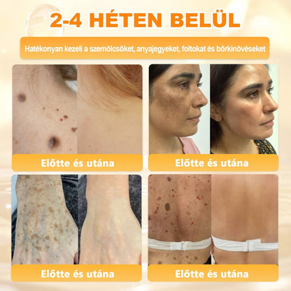 ✨ 𝐏𝐮𝐫𝐚𝐂𝐮𝐫𝐞® 𝐌é𝐡𝐦é𝐫𝐞𝐠 𝐁ő𝐫 𝐇𝐞𝐥𝐲𝐫𝐞á𝐥𝐥í𝐭ó 𝐊𝐫é𝐦 👨‍⚕‍CE Tanúsítvány ✅GMP-követő gyártási folyamat