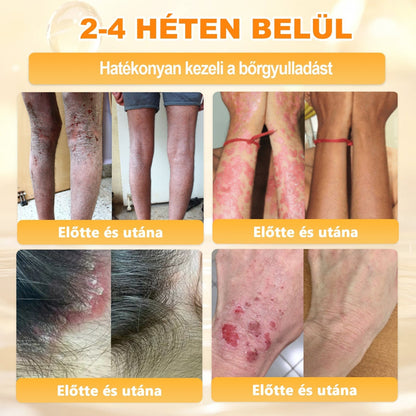 ✨ 𝐏𝐮𝐫𝐚𝐂𝐮𝐫𝐞® 𝐌é𝐡𝐦é𝐫𝐞𝐠 𝐁ő𝐫 𝐇𝐞𝐥𝐲𝐫𝐞á𝐥𝐥í𝐭ó 𝐊𝐫é𝐦 👨‍⚕‍CE Tanúsítvány ✅GMP-követő gyártási folyamat
