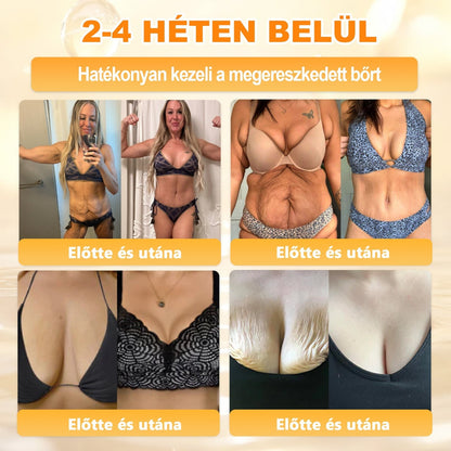 ✨ 𝐏𝐮𝐫𝐚𝐂𝐮𝐫𝐞® 𝐌é𝐡𝐦é𝐫𝐞𝐠 𝐁ő𝐫 𝐇𝐞𝐥𝐲𝐫𝐞á𝐥𝐥í𝐭ó 𝐊𝐫é𝐦 👨‍⚕‍CE Tanúsítvány ✅GMP-követő gyártási folyamat