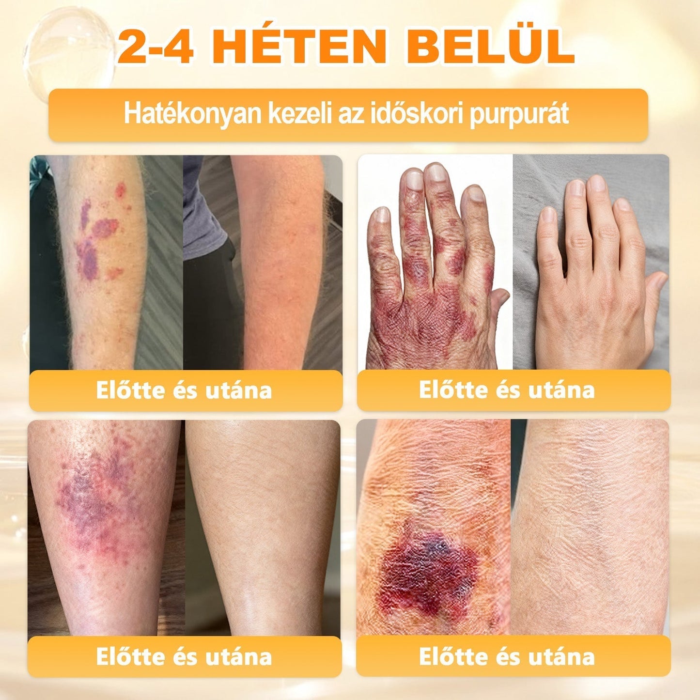 ✨ 𝐏𝐮𝐫𝐚𝐂𝐮𝐫𝐞® 𝐌é𝐡𝐦é𝐫𝐞𝐠 𝐁ő𝐫 𝐇𝐞𝐥𝐲𝐫𝐞á𝐥𝐥í𝐭ó 𝐊𝐫é𝐦 👨‍⚕‍CE Tanúsítvány ✅GMP-követő gyártási folyamat