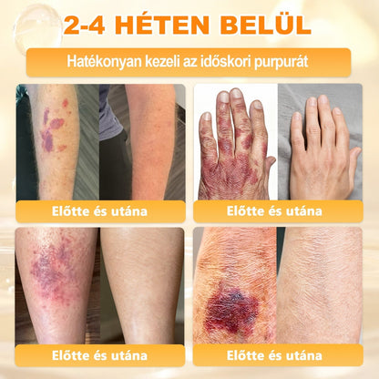 ✨ 𝐏𝐮𝐫𝐚𝐂𝐮𝐫𝐞® 𝐌é𝐡𝐦é𝐫𝐞𝐠 𝐁ő𝐫 𝐇𝐞𝐥𝐲𝐫𝐞á𝐥𝐥í𝐭ó 𝐊𝐫é𝐦 👨‍⚕‍CE Tanúsítvány ✅GMP-követő gyártási folyamat