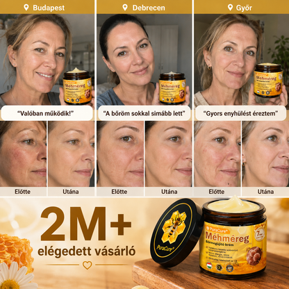 ✨ 𝐏𝐮𝐫𝐚𝐂𝐮𝐫𝐞® 𝐌é𝐡𝐦é𝐫𝐞𝐠 𝐁ő𝐫 𝐇𝐞𝐥𝐲𝐫𝐞á𝐥𝐥í𝐭ó 𝐊𝐫é𝐦 👨‍⚕‍CE Tanúsítvány ✅GMP-követő gyártási folyamat